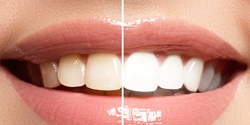 Before and after cosmetic dentistry in Edmond