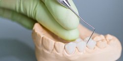 a person in Edmond working on a dental bridge