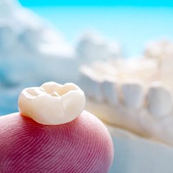 a dental crown sitting on top of a person’s finger