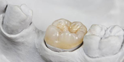 Dental crown