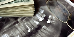 Money next to a dental x-ray