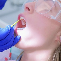 A woman getting fluoride treatment