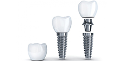 dental crown, abutment, and dental implant post
