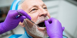 dentist examining a patient’s mouth during dental implant consultation