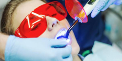 Intraoral Laser