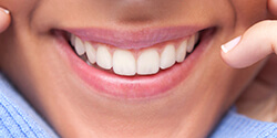 closeup of smile after dental bonding