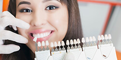 Woman's smile compared with tooth color chart after teeth whitening