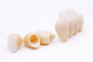 dental crowns