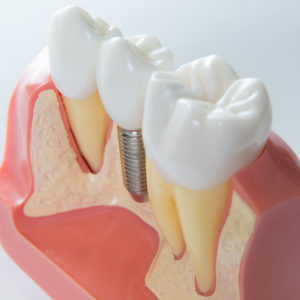 Dentures And Dental Services Nw Expressway  : We Will Attempt To Reply Back As Quickly As Possible.