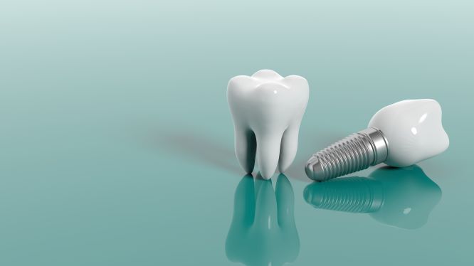 Types of dental implants