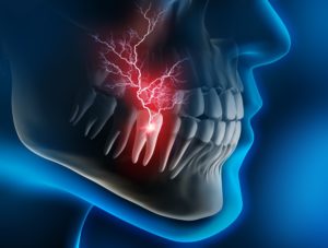 Digital model of a toothache requiring an emergency dentist.