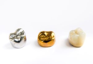 A silver, gold, and tooth-colored dental crown sitting side by side